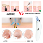 DermaSuction - Puntos Negros y Espinillas