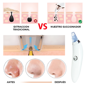 DermaSuction - Puntos Negros y Espinillas